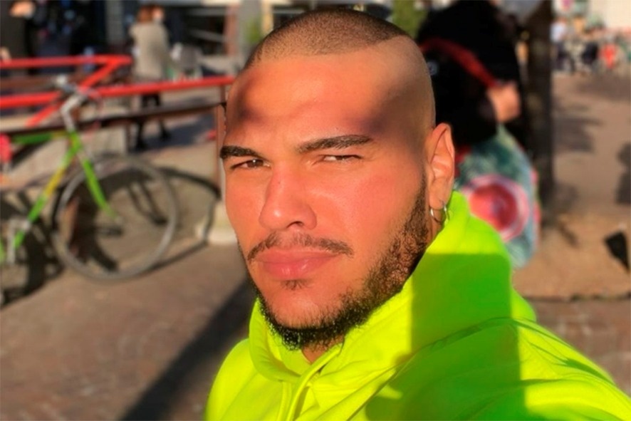 Modelo brasileiro Gabriel Luiz Dias, de 27 anos