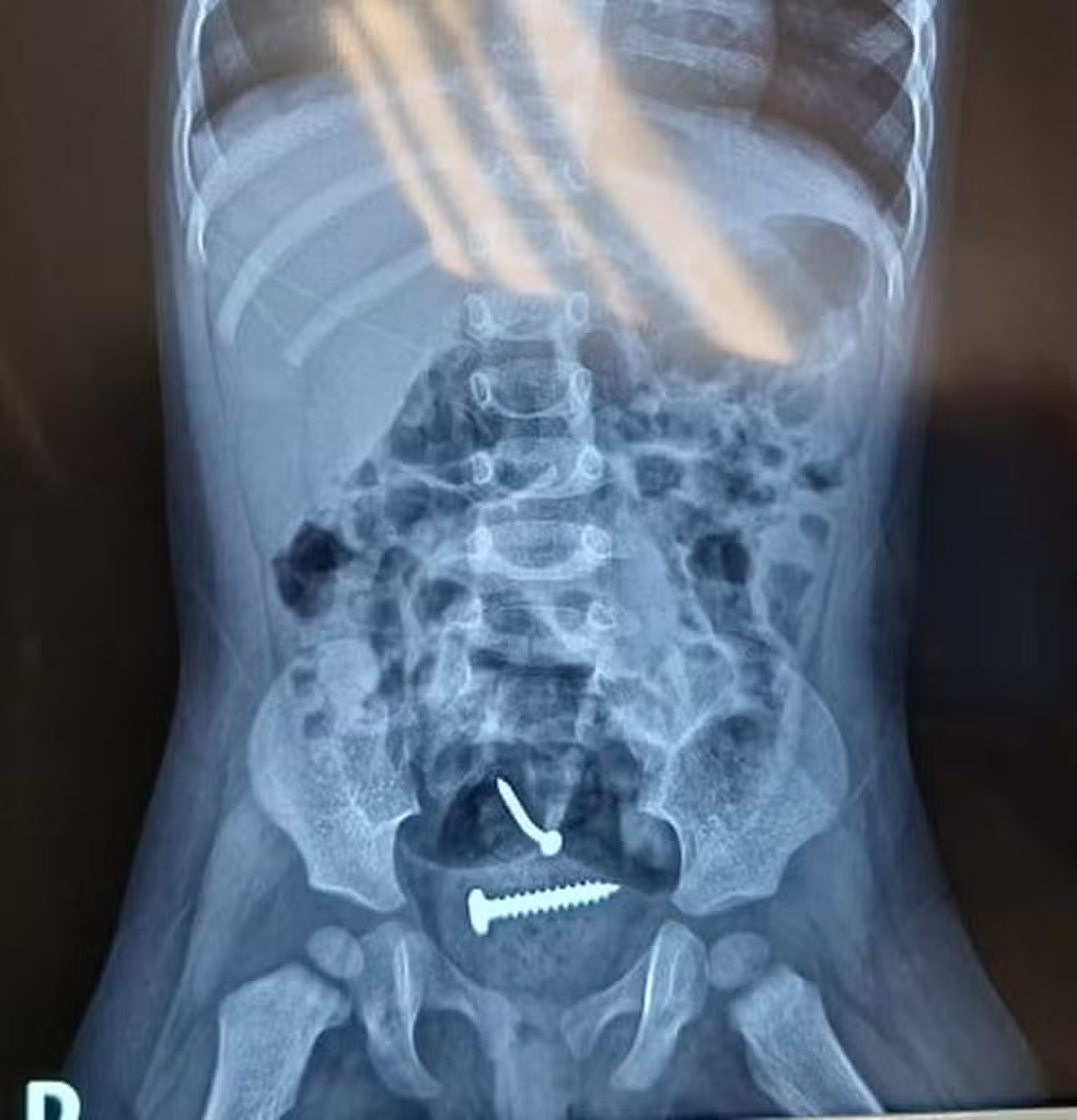 A criança foi encontrada junto com a mãe em um terreno abandonado, antes de serem levadas a um hospital.