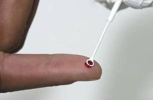 Autoteste de HIV (Foto: Reprodução/ Agência Brasil)