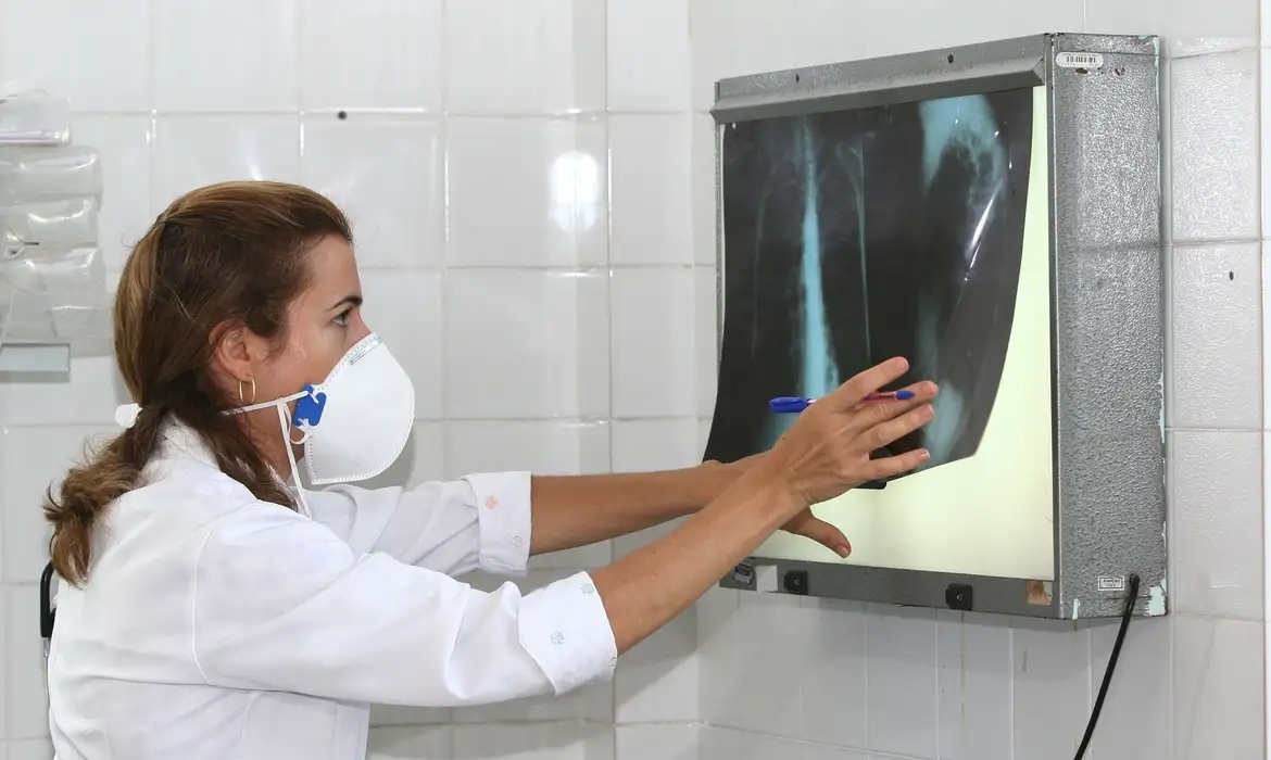 Casos de tuberculose.