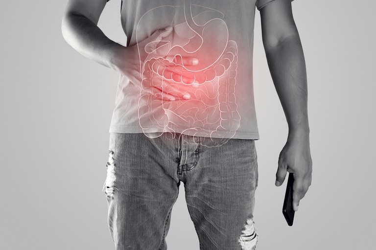 Doenças inflamatórias intestinais.