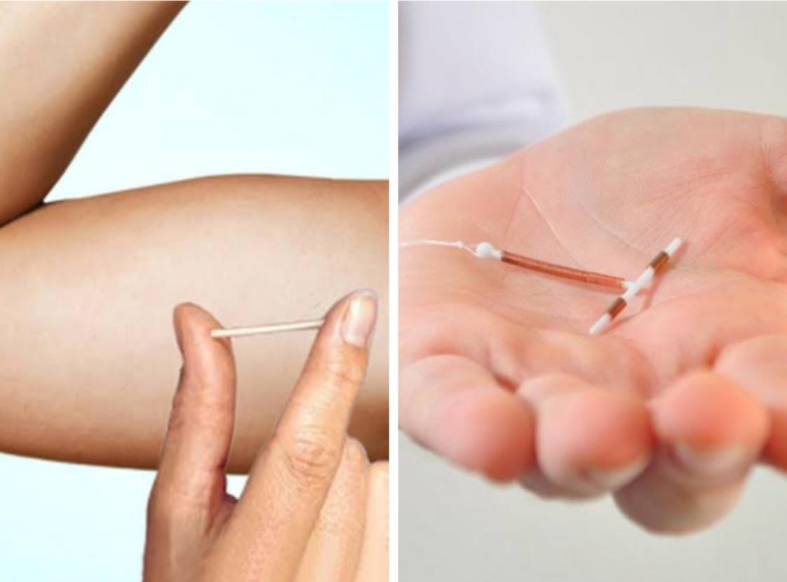 HPM agora oferece métodos contraceptivos, como (DIU) e o Implanon.
