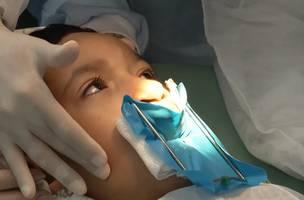 Entenda: SUS garantirá tratamento completo para lábio leporino. (Foto: Reprodução/ Agência Brasil)