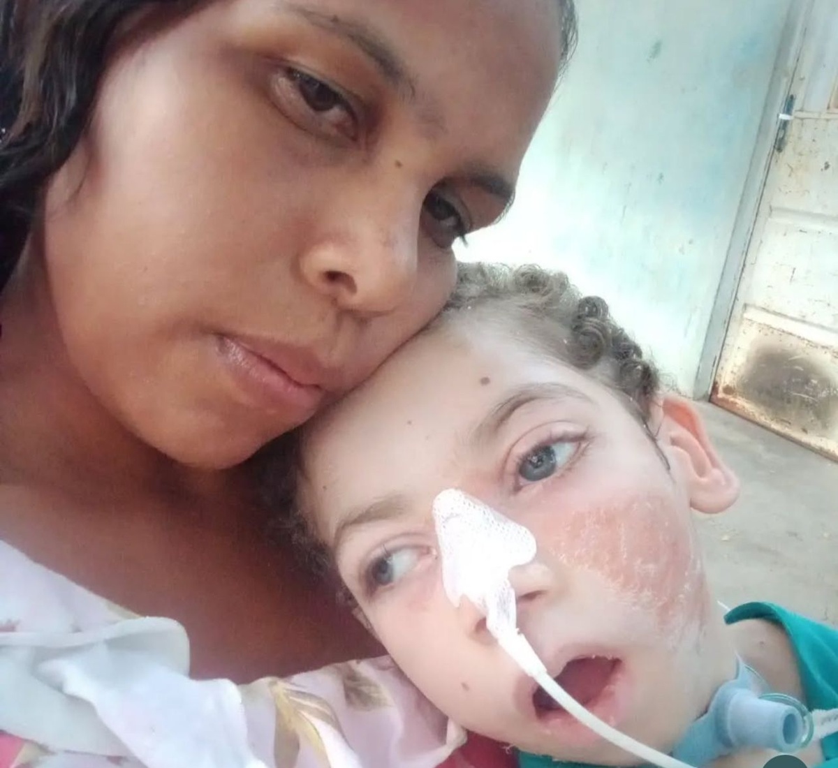 Mãe faz campanha para manter tratamento de filho com traqueostomia em casa.