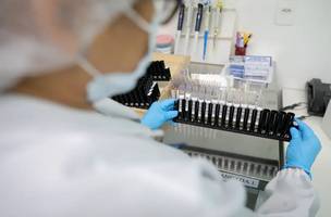 Anvisa libera testes em humanos de vacina brasileira contra malária. (Foto: Reprodução/ Agência Brasil)